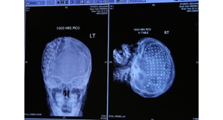 x-rays of a human brain